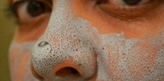 blackhead_home remedies